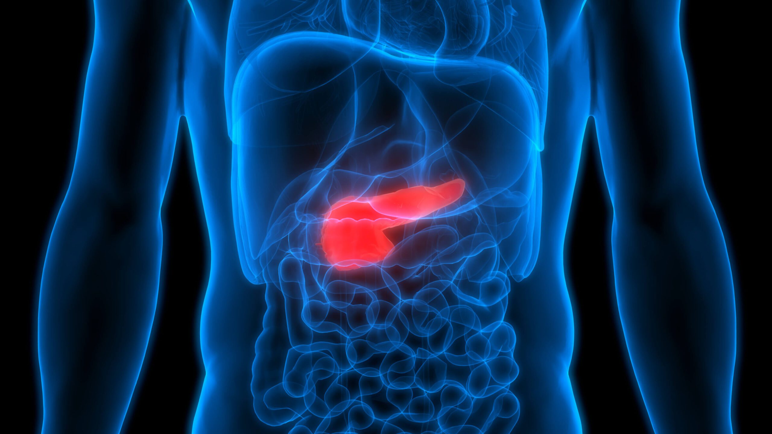 pancreatic-cancer-nrollmed